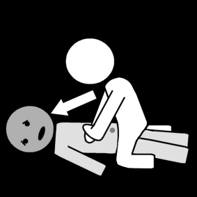 heimlich maneuver